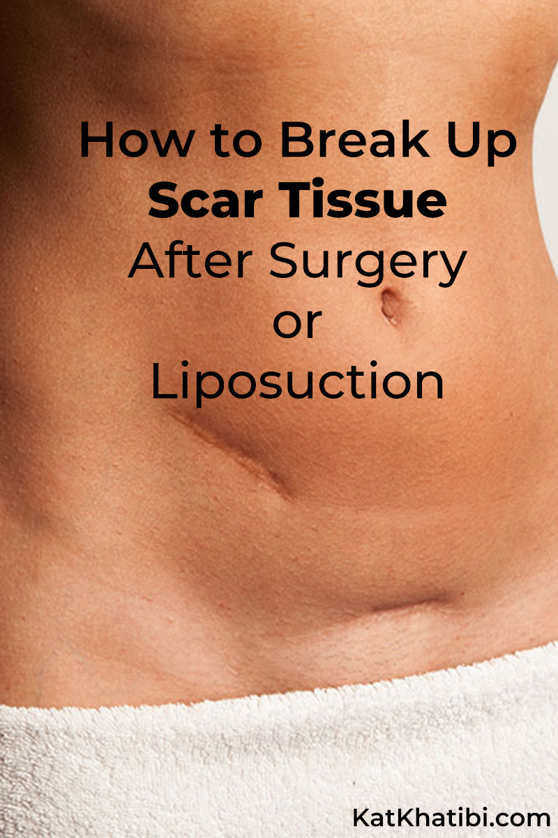How to Break Up Scar Tissue After Surgery Or Liposuction